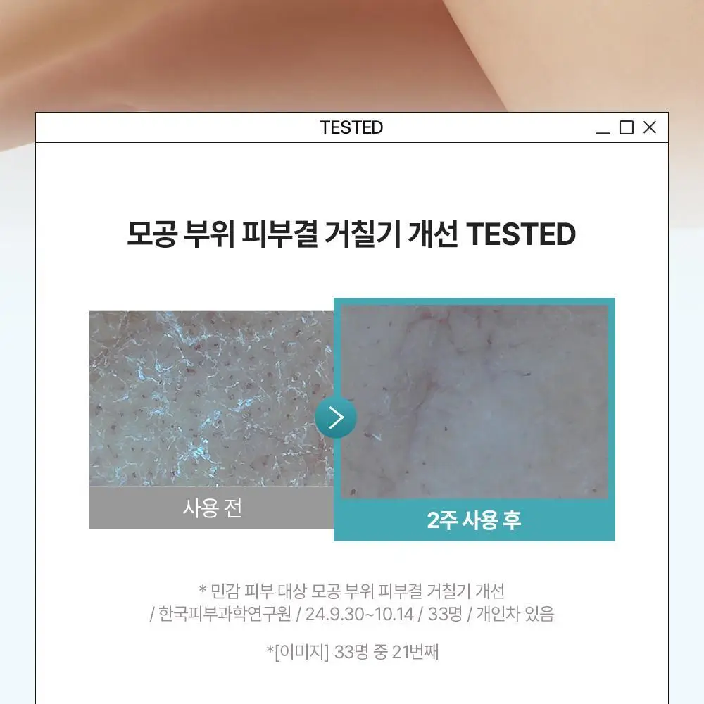 [민감장벽케어/120ml증정]비욘드 바디타민 판테놀 3%고함량 민감진정 바디로션 300ml 단품/기획 상세페이지 27